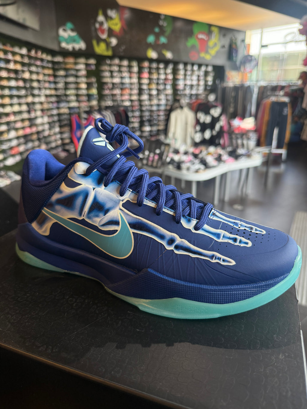 Kobe x ray