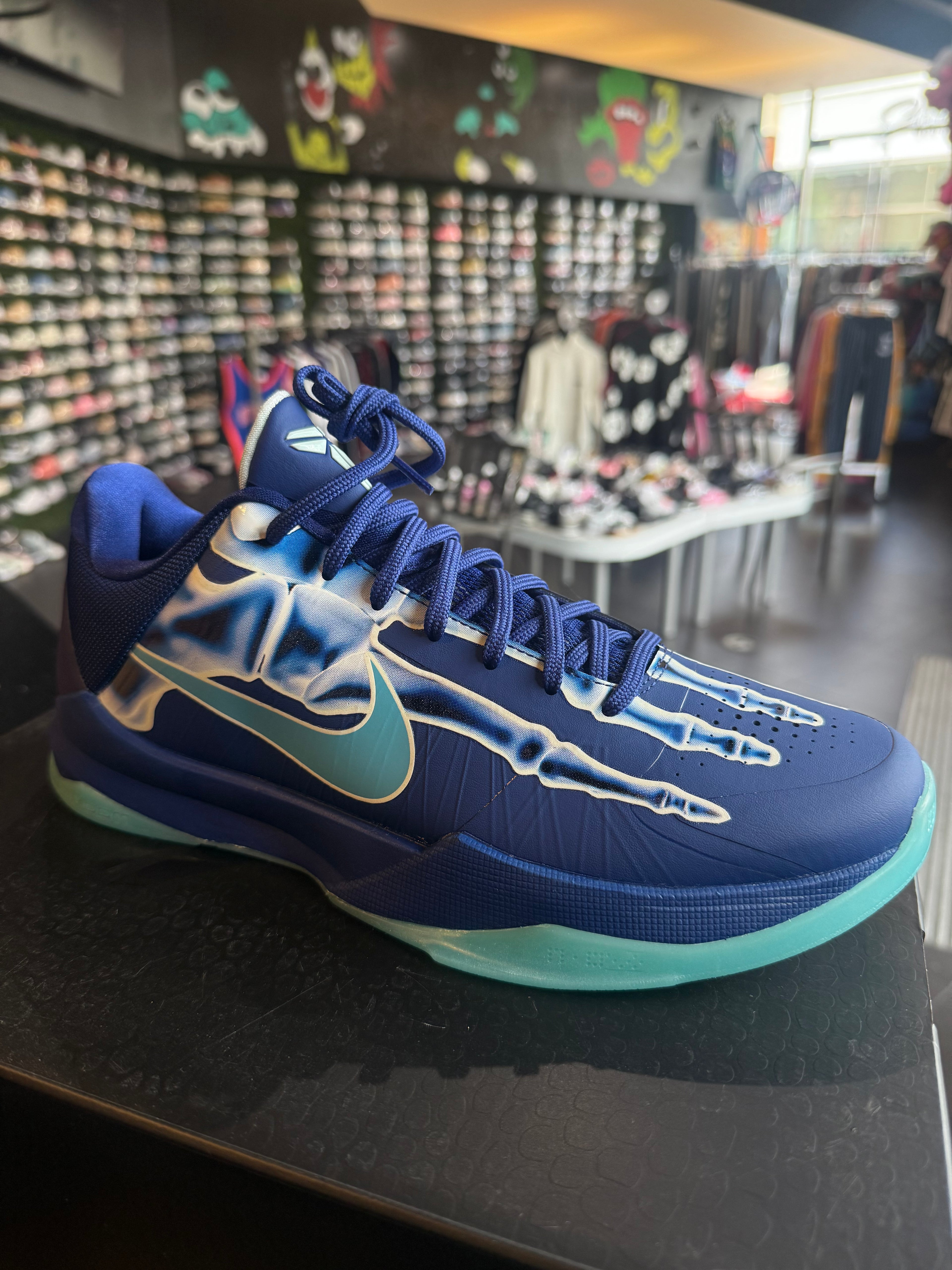Kobe x ray